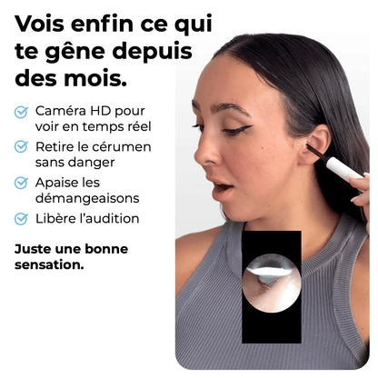 OTOSCOPE EARO – HYGIÈNE AUDITIVE RÉVOLUTIONNÉE